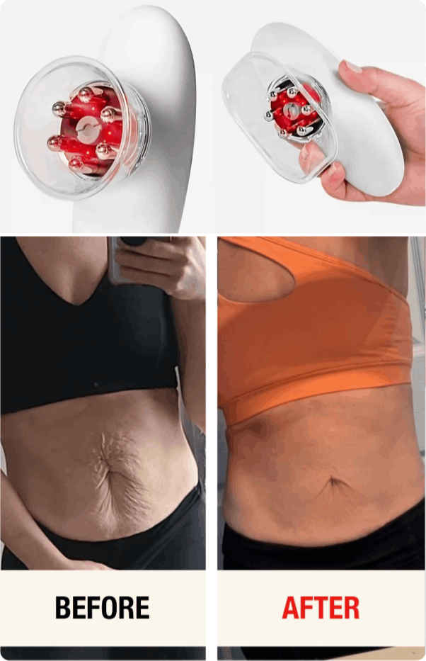 What is Glokore IPL Body Sculptor